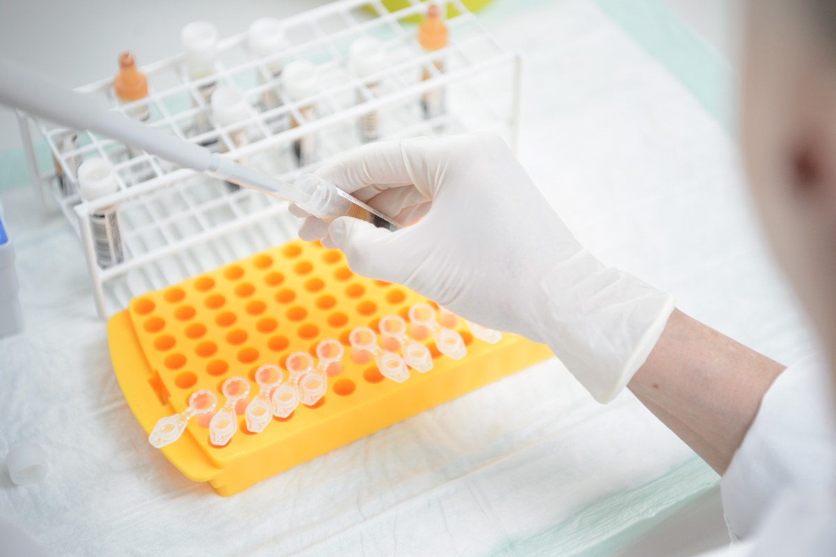 Nebennierenkarzinom Universitätsklinikum Würzburg Medizin I